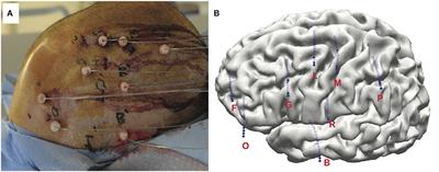 Non-motor Brain Regions in Non-dominant Hemisphere Are Influential in Decoding Movement Speed